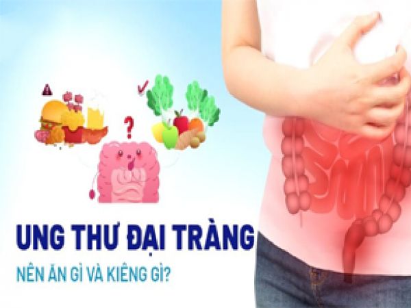DẤU HIỆU NHẬN BIẾT UNG THƯ ĐẠI TRÀNG