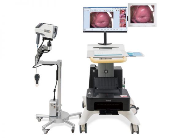 MÁY SOI CỔ TỬ CUNG CÓ MÀN HÌNH PHÍA SAU - MODEL: YKD-3003